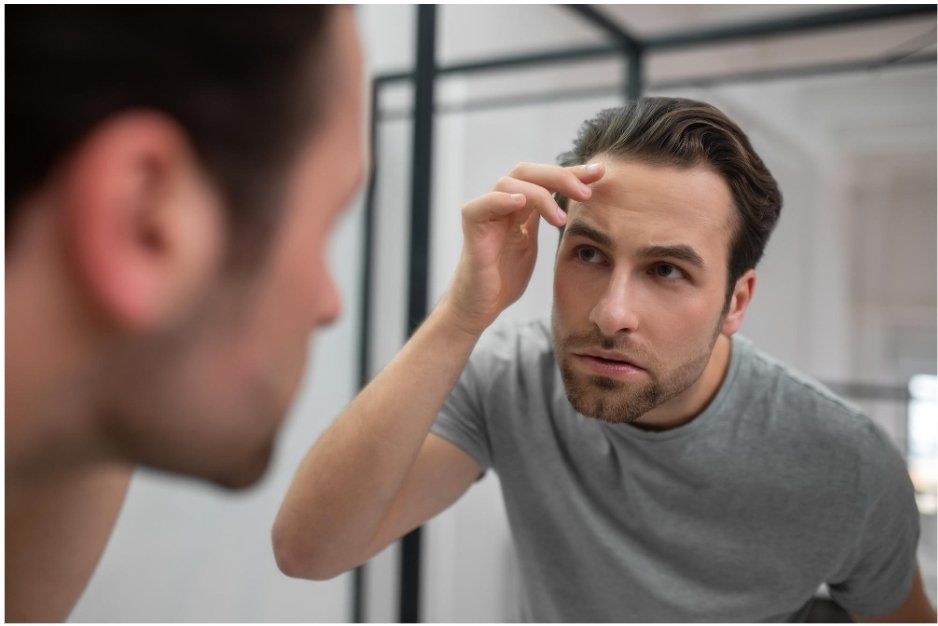 Tips for Men Considering Hair Loss Treatment Melbourne