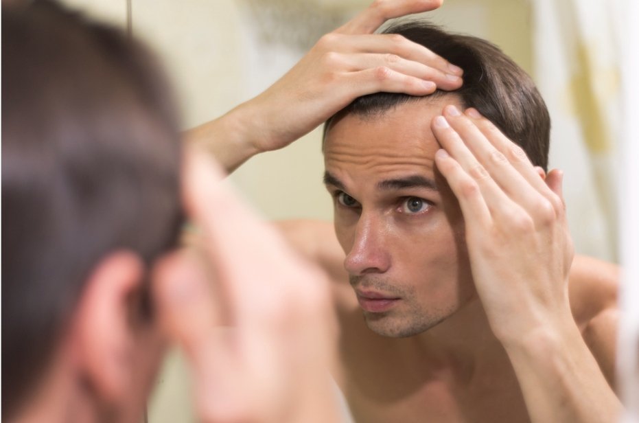 Tips for Men Considering Hair Loss Treatment Melbourne